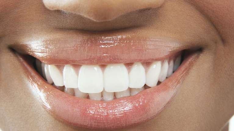 White teeth in Vienna, VA