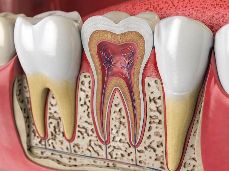 root canal illustration
