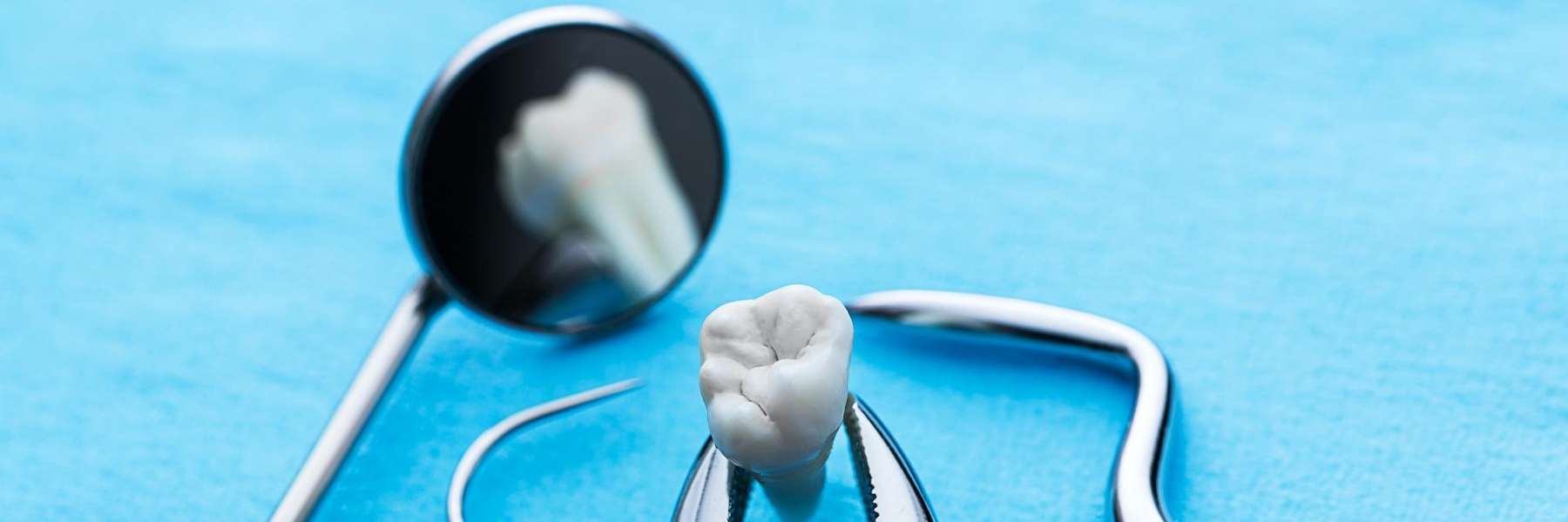 tooth extraction in Vienna VA